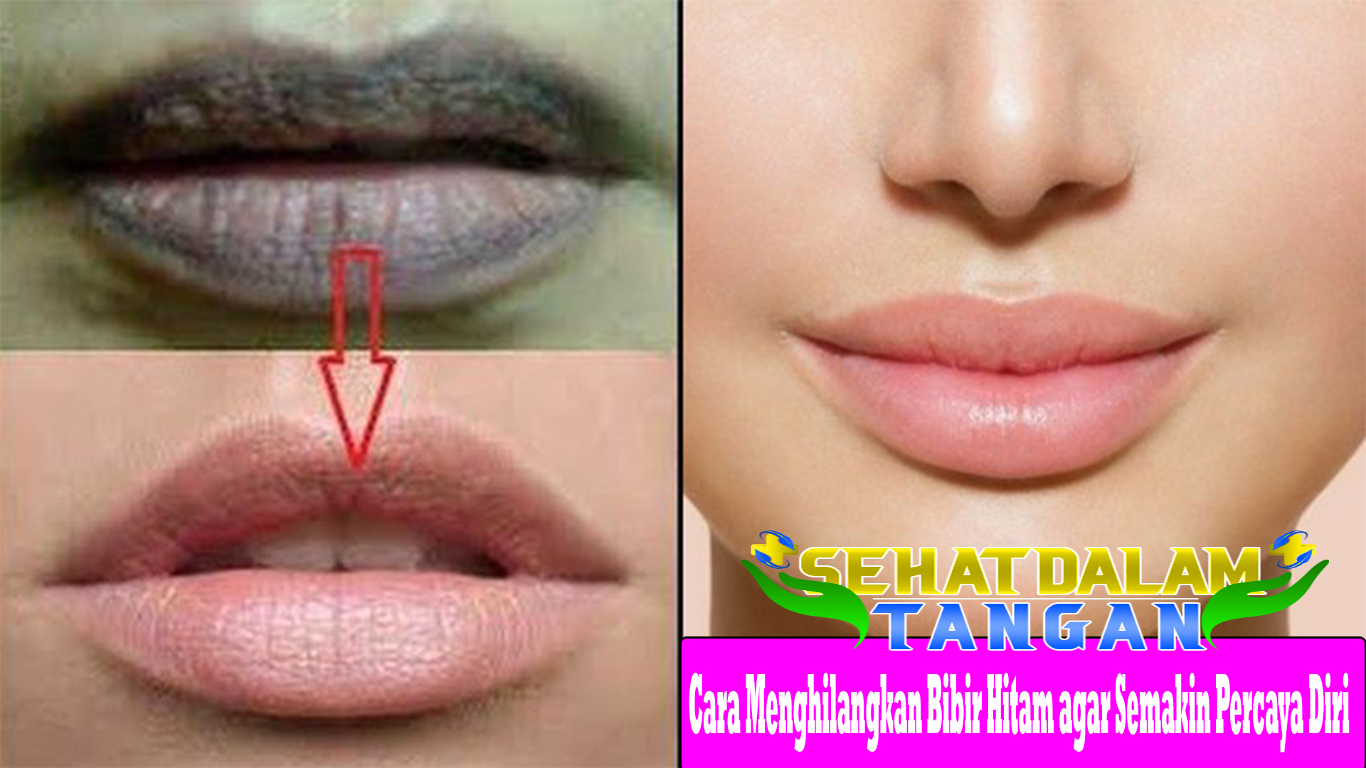 Cara Menghilangkan Bibir Hitam agar Semakin Percaya Diri